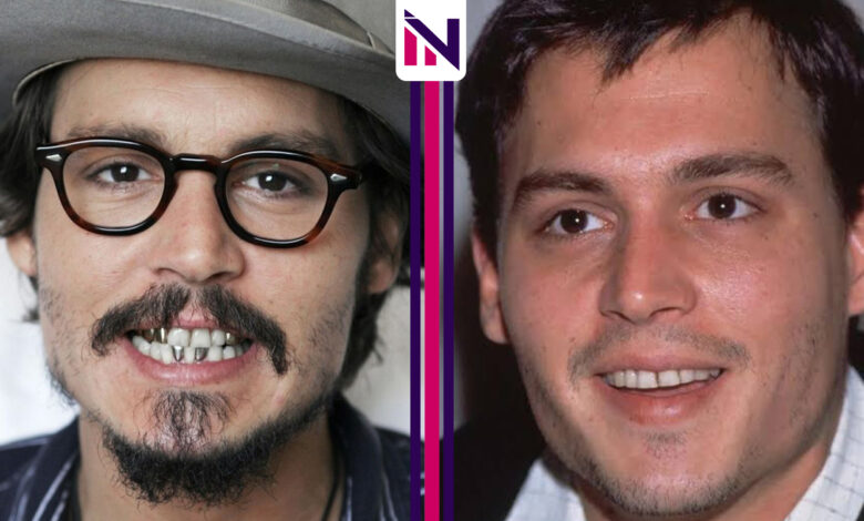 Johnny Depp Teeth